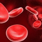 Leukemia: the symptoms & treatment